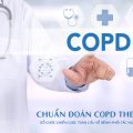 Chuẩn đoán COPD theo GOLD hiện được coi là cơ sở cho việc chuẩn đoán và điều trị căn bệnh này. 