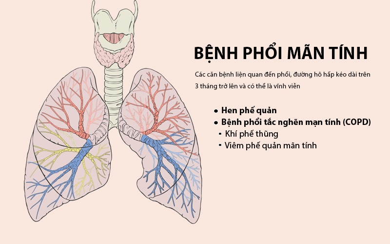 Bệnh phổi mạn tính là các căn bệnh liện quan đến phổi, đường hô hấp kéo dài trên 3 tháng trở lên và có thể là vĩnh viễn