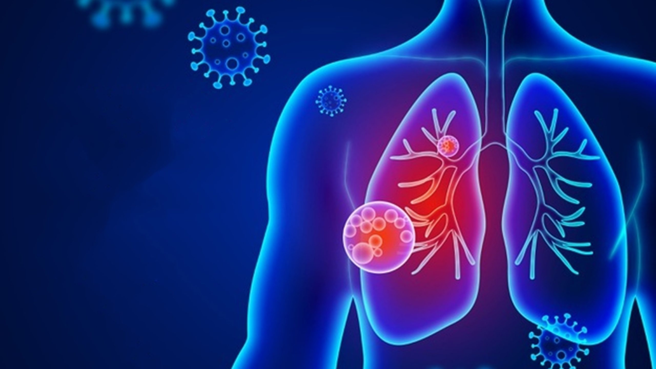 Viêm phổi không đặc hiệu xuất hiện những tổn thương khó phục hồi trong phổi