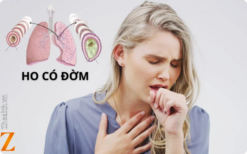 Ho có đờm