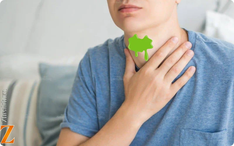 Không ho nhưng có đờm ở cổ họng do nguyên nhân gì?